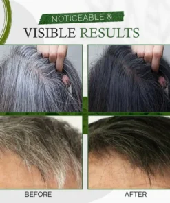 UNPREE™ Kolirin Herbal Hair Dye