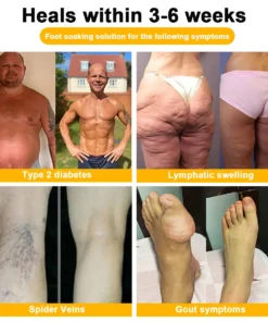 VascuTone™ Bienengift-Fußbadperlen zum Abnehmen und Entgiften