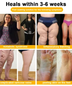 VascuTone™ Bienengift-Fußbadperlen zum Abnehmen und Entgiften