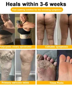 VascuTone™ Bienengift-Fußbadperlen zum Abnehmen und Entgiften