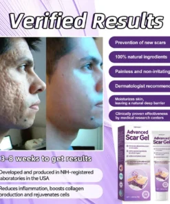 Zoencgz™ Advanced Scar Gel