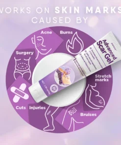 Zoencgz™ Advanced Scar Gel