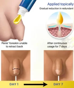 BaoBee™ Redundant Prepuce Corrector Gel - Trusted by Medical Experts!
