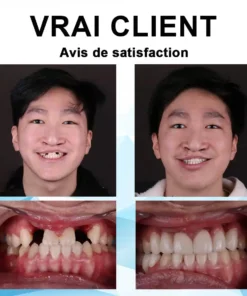 ʻO Bikenda™ Silicone Reline Denture Set