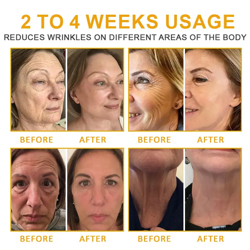 Flysmus™ Natural Collagen Peptide Anti-Wrinkle Firming Multi-Purpose Cream