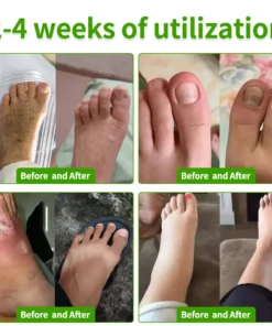 HZA™ FungiVanish Foot Treatment Spray