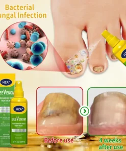 HZA™ FungiVanish Foot Treatment Spray