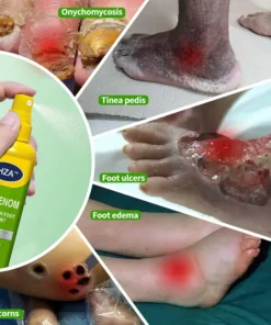 HZA™ FungiVanish Foot Treatment Spray