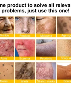 LOVILDS™ Ultimate All-Body Skin Restoration Cream