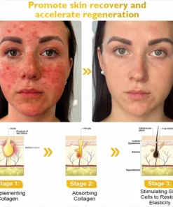 LOVILDS™ Ultimate All-Body Skin Restoration Cream