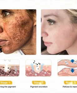 LOVILDS™ Ultimate All-Body Skin Restoration Cream