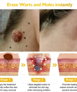 LOVILDS™ Ultimate All-Body Skin Restoration Cream