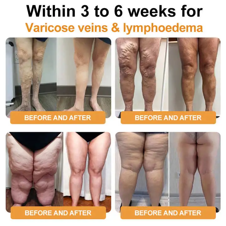 LOVILDS™ Ultrasonic Fat Blasting & Far Infrared Blood Sugar Balancing Detox Wristband