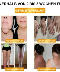 LOVILDS™ Ultrasonic Fat Blasting & Far Infrared Blood Sugar Balancing Detox Wristband