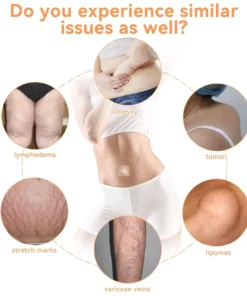 NESLEMY™ Honey Bee Lymphatic Drainage Slimming Patch