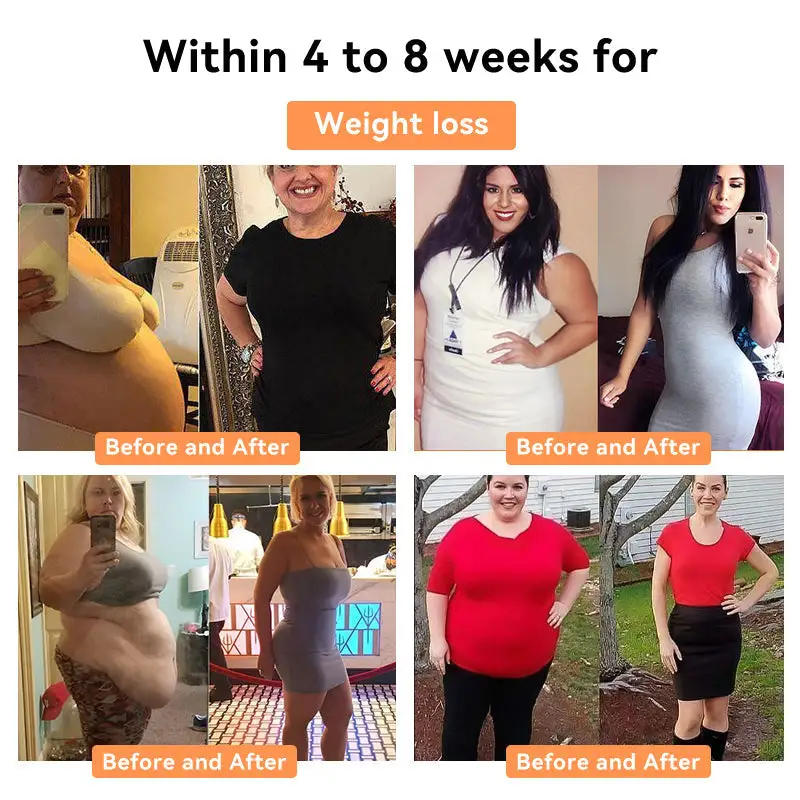 NESLEMY™ Honey Bee Lymphatic Drainage Slimming Patch