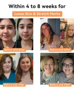 NESLEMY™ Honey Bee Lymphatic Drainage Slimming Patch