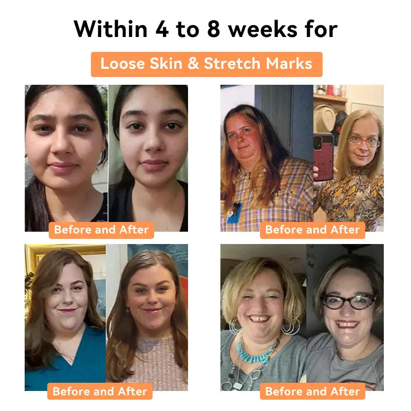 NESLEMY™ Honey Bee Lymphatic Drainage Slimming Patch