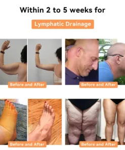 NESLEMY™ Honey Bee Lymphatic Drainage Slimming Patch