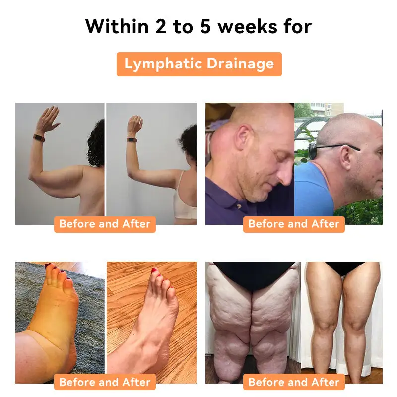 NESLEMY™ Honey Bee Lymphatic Drainage Slimming Patch