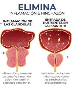 Oveallgo™ Collar curativo de titanio ProstaCore