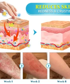 TODAHOFβ’ Bee Venom Multi-Symptom Treatment Cream