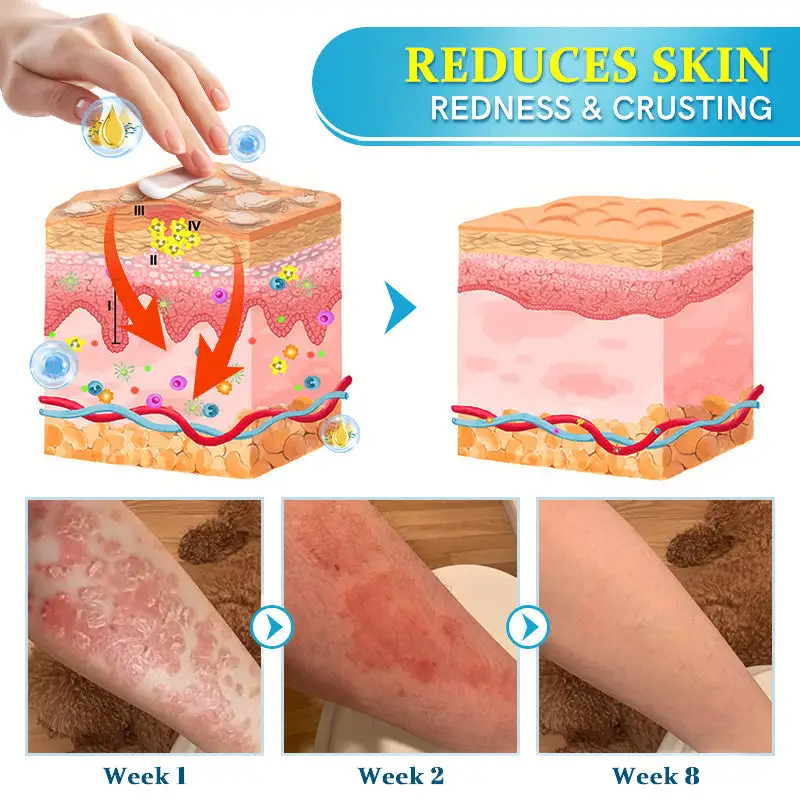 TODAHOFβ’ Bee Venom Multi-Symptom Treatment Cream