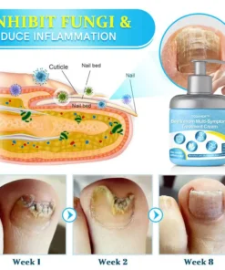 TODAHOFβ’ Bee Venom Multi-Symptom Treatment Cream