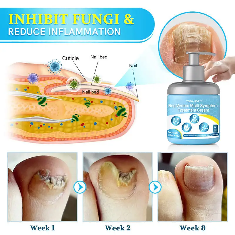 TODAHOFβ’ Bee Venom Multi-Symptom Treatment Cream