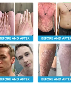 TODAHOFβ’ Bee Venom Multi-Symptom Treatment Cream