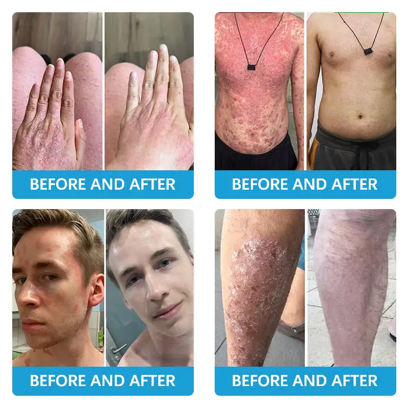 TODAHOFβ’ Bee Venom Multi-Symptom Treatment Cream