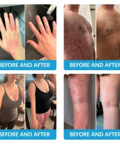 TODAHOFβ’ Bee Venom Multi-Symptom Treatment Cream