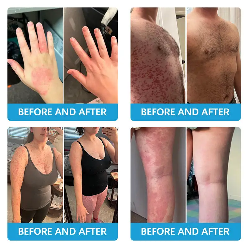 TODAHOFβ’ Bee Venom Multi-Symptom Treatment Cream