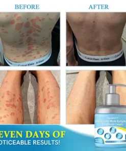 TODAHOFβ’ Bee Venom Multi-Symptom Treatment Cream