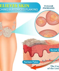 TODAHOFβ’ Bee Venom Multi-Symptom Treatment Cream