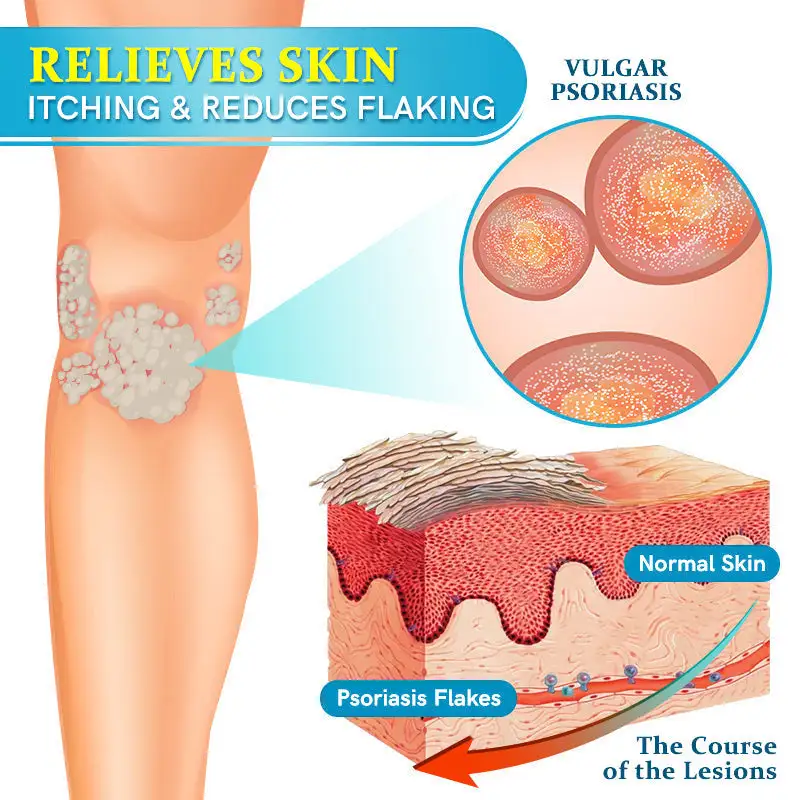 TODAHOFβ’ Bee Venom Multi-Symptom Treatment Cream