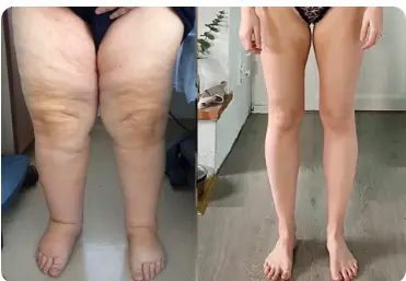 CZTICLE™ Boucles d'oreilles de thérapie magnétique en diamant bleu incolore - Image 48