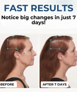 Alternative view of HairGenix™ Hair Regrowth Capsules