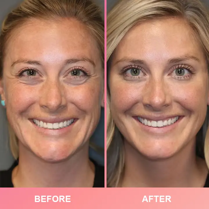 LIMETOW™ Compact Anti-wrinkle Bar - Image 7