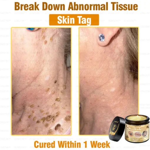 كريم Lotmay™ 7-Day Rapid Skin Rapair المعتمد من أطباء الجلدية في الولايات المتحدة - الصورة 4