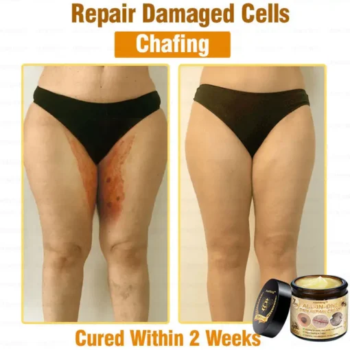 كريم Lotmay™ 7-Day Rapid Skin Rapair المعتمد من أطباء الجلدية في الولايات المتحدة - الصورة 5