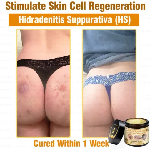 كريم Lotmay™ 7-Day Rapid Skin Rapair المعتمد من أطباء الجلدية في الولايات المتحدة - الصورة 6