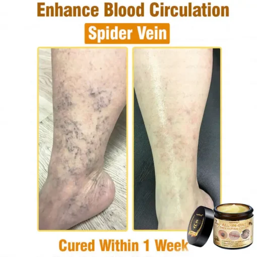 كريم Lotmay™ 7-Day Rapid Skin Rapair المعتمد من أطباء الجلدية في الولايات المتحدة - الصورة 7