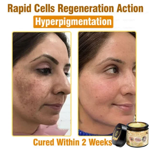 كريم Lotmay™ 7-Day Rapid Skin Rapair المعتمد من أطباء الجلدية في الولايات المتحدة - الصورة 9