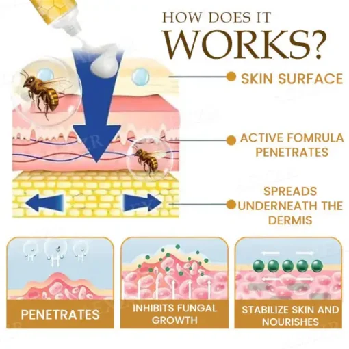 تخفيضات الشتاء على كريم AEXZR™ Bee Venom Genital Itch Relief - الصورة 3