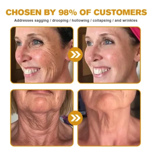 تخفيضات الشتاء على كريم إزالة التجاعيد Furzero™ Botox Bee Venom - الصورة 6