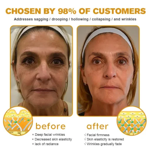 تخفيضات الشتاء على كريم إزالة التجاعيد Furzero™ Botox Bee Venom - الصورة 7