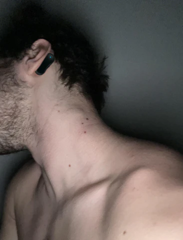 Audinix™ Tinnitus Relieving Device