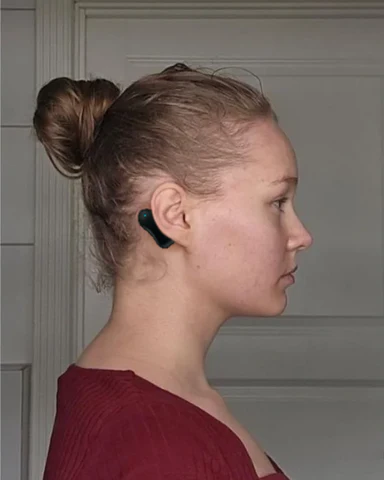 Audinix™ Tinnitus Relieving Device