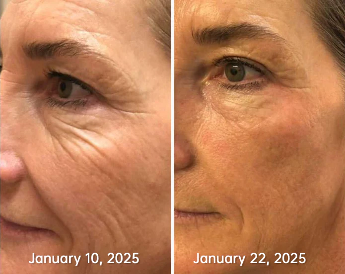 Furzero™ Botox Bee Venom Wrinkle Removal Serum Stick